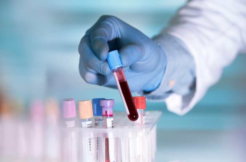 laboratoriniai tyrimai